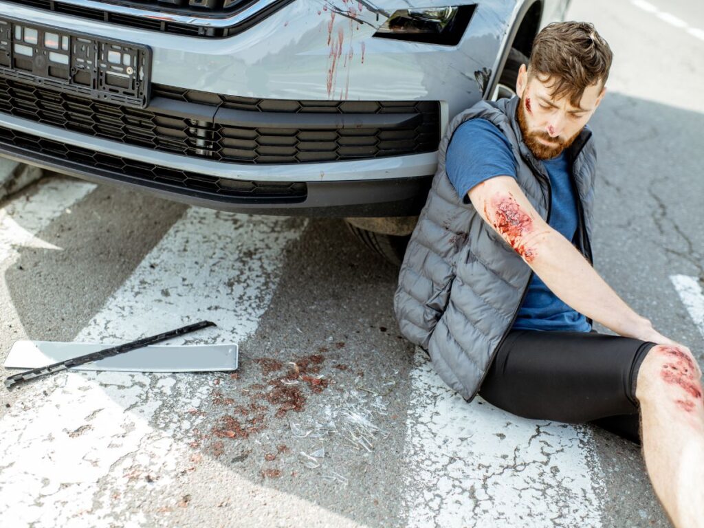 Pedestrian Accident Injury Services