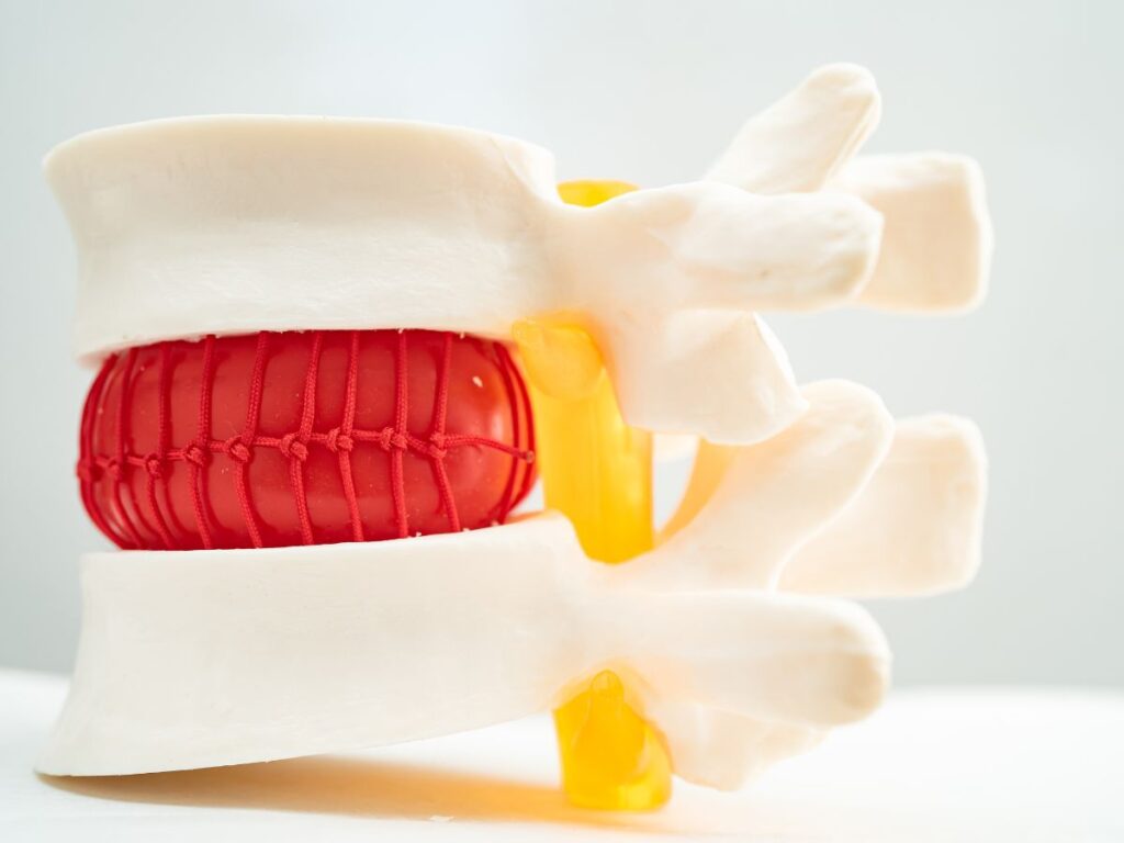 Chiropractic Care for Herniated Disc