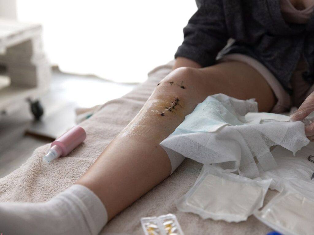 Post-Operative Shoulder Surgery Rehabilitation