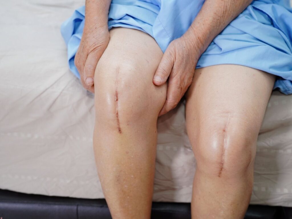Pre-Surgical Rehab for Joint Replacement