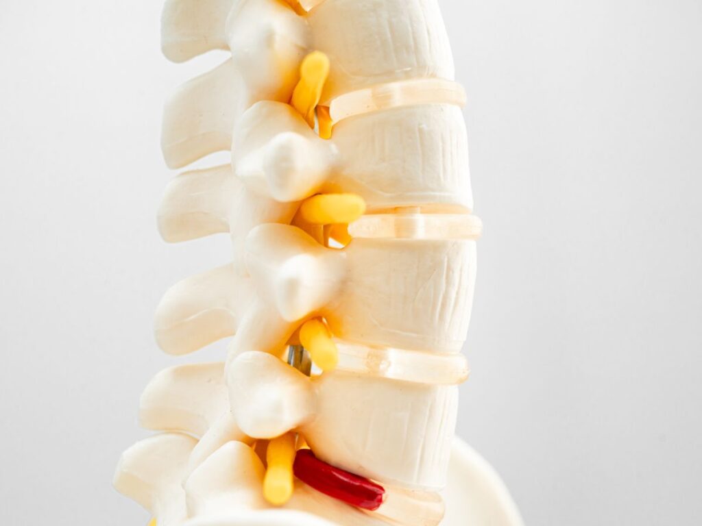 Spinal Decompression for Bulging Disc Relief