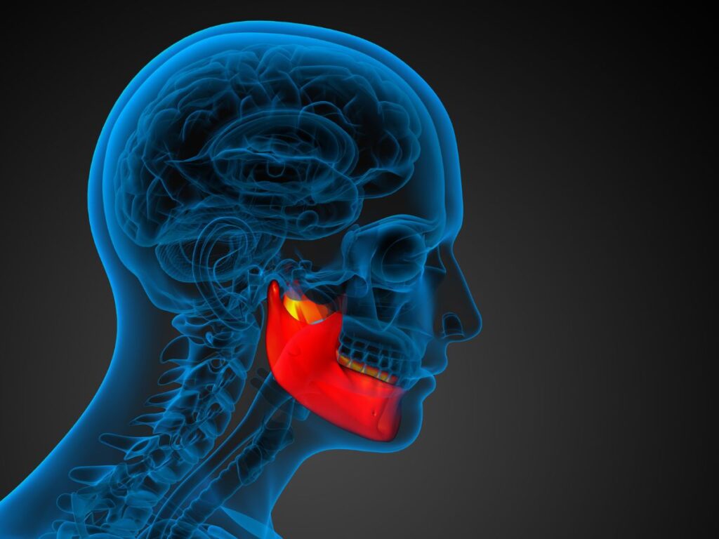 TMJ Therapy for Jaw Locking Issues