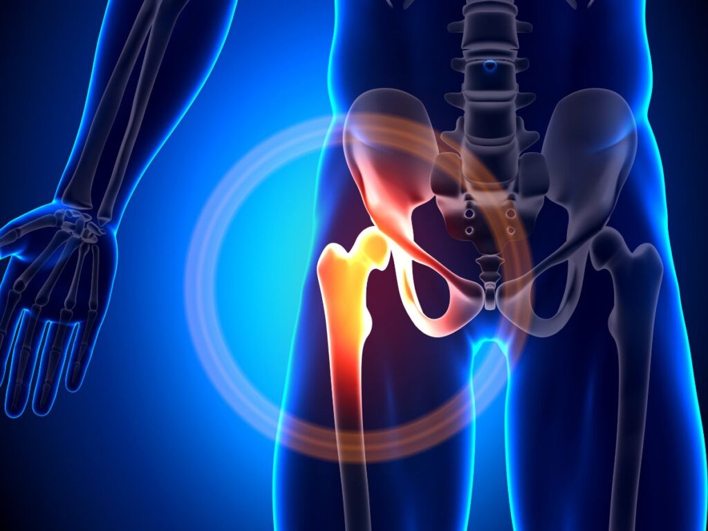 Chiropractic for Hip and Pelvis Alignment