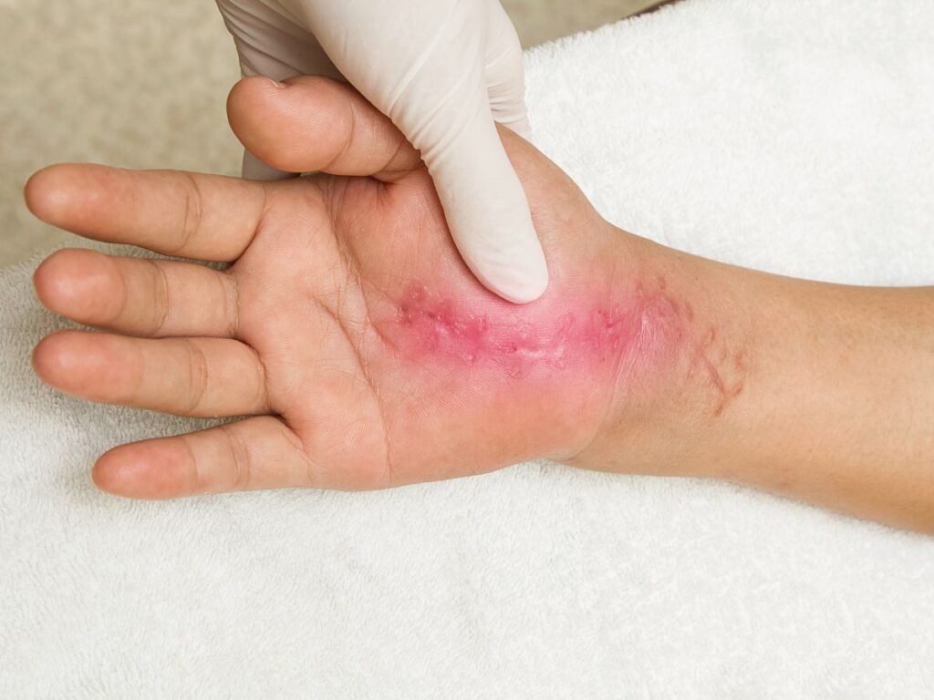 Facial Injuries and Scarring Recovery