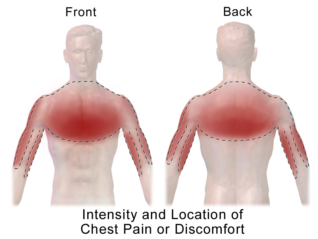 Understanding Non-Cardiac Chest Pain & Effective Relief Therapies